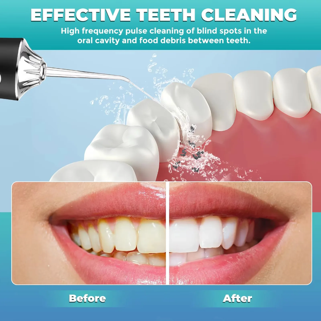 dental equipment